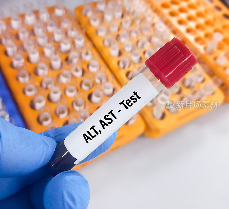 抽血进行ALT (SGPT)、AST (SGOT)检测、肝功能检测。